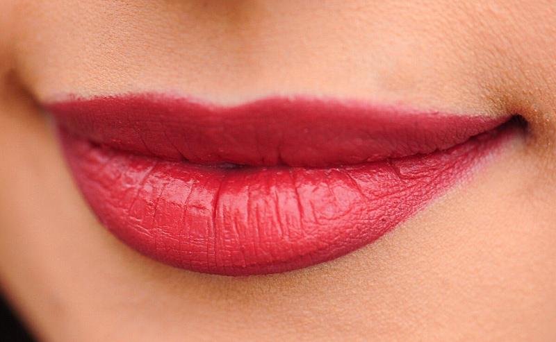 lip filler Lip Enhancements
