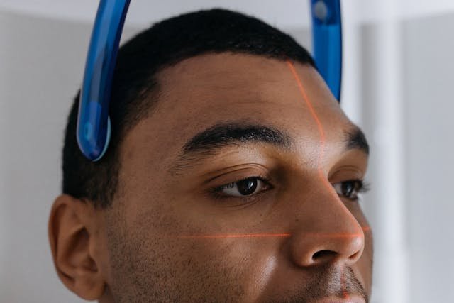 Pico Laser Treatment: Can It Reverse Years of Sun Damage in Southeast Asian Skin? Pico laser treatment benefits